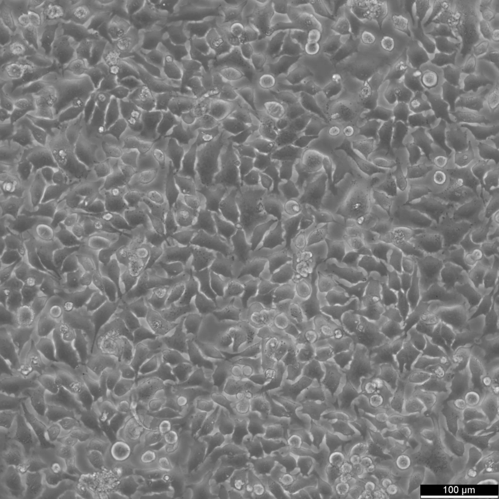 HeLa Cells